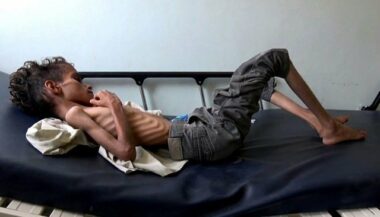 85.000 enfants morts de faim ou de maladie au Yémen, selon Save the Children