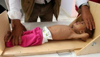Une malnutrition &ldquo;alarmante&rdquo; touche la planète