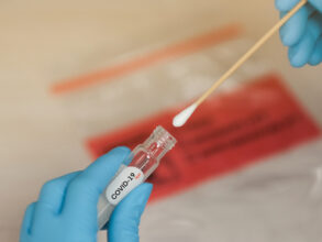 Tests Covid-19 : les modalités de remboursement et prise en charge par la CNOPS