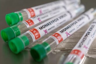 Monkeypox : voici les changements apportés au protocole de surveillance et de riposte